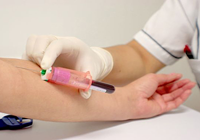 Цены на анализы крови в бресте